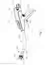 Fig. 02 - Apparatus and method for pleating a bodily lumen