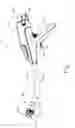 Fig. 02 - Apparatus and method for radially bunching a bodily lumen