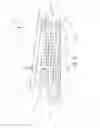 Fig. 35 - Implantable layer comprising plastically deformed fibers