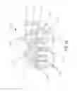 Fig. 41 - Implantable layer comprising plastically deformed fibers
