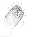 Fig. 86 - Implantable layer comprising plastically deformed fibers