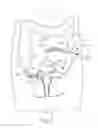 Fig. 07 - Apparatus and method for cinching a straight staple line