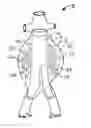 Fig. 01 - Embolization device and a method of using the same