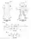 Fig. 02 - Embolization device and a method of using the same