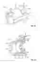 Fig. 14 - Embolization device and a method of using the same