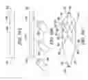 Fig. 35 - Clot retrieval system