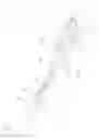 Fig. 02 - ASYMMETRIC MEMBRANE REMOVING FORCEPS