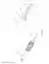 Fig. 09 - ASYMMETRIC MEMBRANE REMOVING FORCEPS