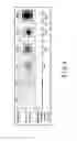 Fig. 04 - TREATMENT METHOD USING ULTRASONIC SURGICAL SYSTEM