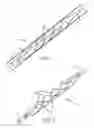 Fig. 02 - Balloon catheter with non-deployable stent having improved stability