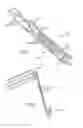Fig. 07 - Balloon catheter with non-deployable stent having improved stability
