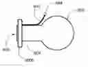 Fig. 01 - Trans-endoscopic and laparoscopic surgery port