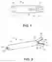 Fig. 02 - Implant fixation devices and methods of using the same