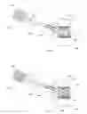 Fig. 08 - Reduced extravasation of bone cement