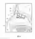 Fig. 04 - System and method for sinus surgery