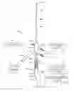 Fig. 01 - Tissue extraction devices and methods