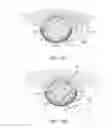 Fig. 23 - Tissue extraction devices and methods