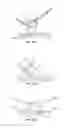 Fig. 06 - Ablation catheter electrode having multiple thermal sensors and method of use
