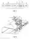 Fig. 03 - Hybrid robotic surgery with locking mode