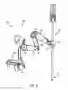 Fig. 04 - Hybrid robotic surgery with locking mode