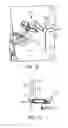 Fig. 10 - Hybrid robotic surgery with locking mode