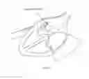 Fig. 155 - Robotic catheter system and methods
