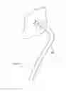 Fig. 170 - Robotic catheter system and methods