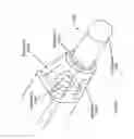 Fig. 172 - Robotic catheter system and methods