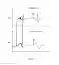 Fig. 176 - Robotic catheter system and methods