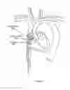 Fig. 181 - Robotic catheter system and methods