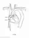 Fig. 182 - Robotic catheter system and methods