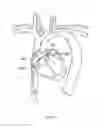Fig. 183 - Robotic catheter system and methods