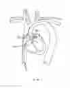 Fig. 187 - Robotic catheter system and methods