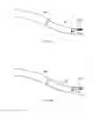 Fig. 233 - Robotic catheter system and methods