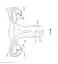 Fig. 243 - Robotic catheter system and methods