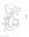 Fig. 255 - Robotic catheter system and methods