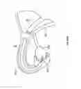 Fig. 259 - Robotic catheter system and methods