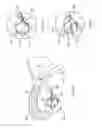 Fig. 260 - Robotic catheter system and methods