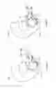 Fig. 261 - Robotic catheter system and methods