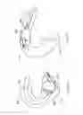 Fig. 262 - Robotic catheter system and methods