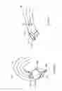 Fig. 273 - Robotic catheter system and methods
