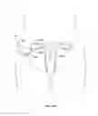 Fig. 274 - Robotic catheter system and methods
