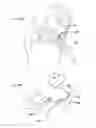 Fig. 280 - Robotic catheter system and methods