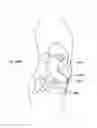 Fig. 281 - Robotic catheter system and methods