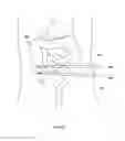 Fig. 282 - Robotic catheter system and methods