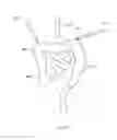 Fig. 295 - Robotic catheter system and methods