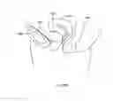 Fig. 302 - Robotic catheter system and methods
