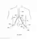 Fig. 303 - Robotic catheter system and methods