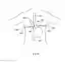 Fig. 306 - Robotic catheter system and methods