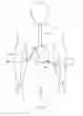 Fig. 308 - Robotic catheter system and methods